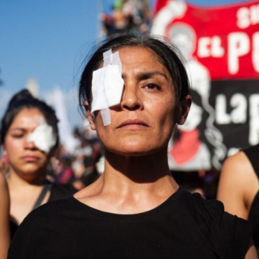 Demonstrators gather on 29 November 2019 in the center of the Santiago de Chile, Chile to protest against the abuses of the security forces, including eye injuries from misuse of weapons. Photo by Federico Rotter/NurPhoto via Getty Images.